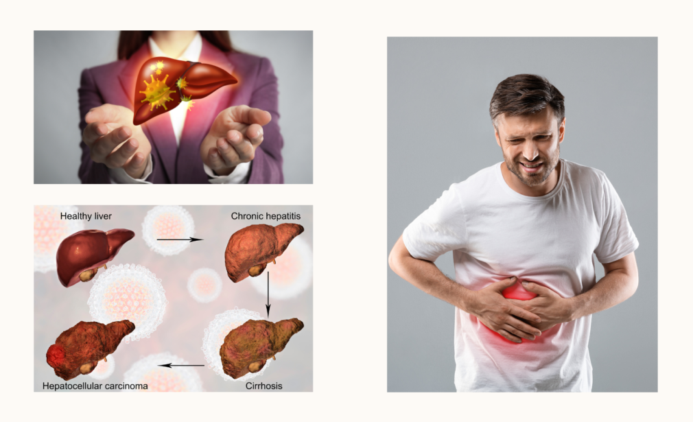 Understanding Symptoms, Diagnosis, and Treatment of Liver Diseases in India
